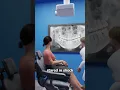 Download Lagu Alien Implant At The Dentist? 😨