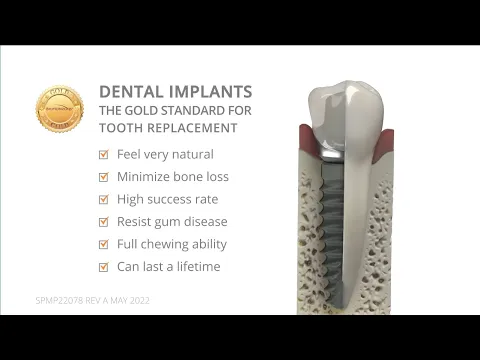 Video thumbnail: Dental implant tooth vs. natural tooth (BioHorizons animation)