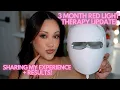 Download Lagu MY THREE MONTH UPDATE USING THE ULIKE REGLOW LED FACE MASK! | RED LIGHT THERAPY MASK | AMY GLAM ❤️