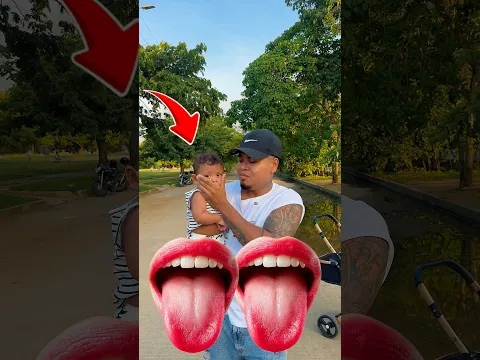 A mi hijo le salieron dos bocas 👄😱😨 #shorts #viral #fyp #parati #viralshorts #viralvideo