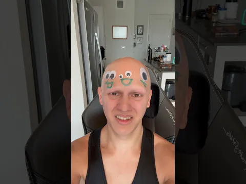 The gang’s all here 😔🧽 #comedy #funny #bald #relatable #alopecia