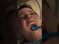The better way to palatal expansion