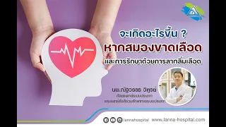 สมองขาดเลือดเกิดจากอะไร และมีผลต่อร่างกายอย่างไรบ้าง