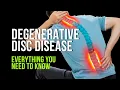 Download Lagu Degenerative Disc Disease Explained for Everyone!