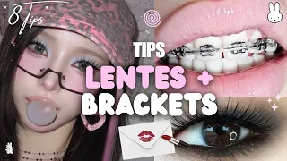 Haz ESTO para LUCIR BONITA usando LENTES + BRACKETS (8 TIPS) 🧸💗
