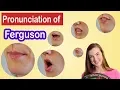 How to pronounce Ferguson American English Pronunciation Lesson