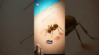 لماذا نشعر بألم شديد من قرصة النمله   دندنها