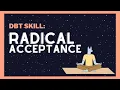 Radical Acceptance How to Change Your Life by Accepting it First DBT Skills from Experts