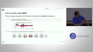 MNE Python to See the Brain at a Millisecond Time Scale SciPy 2017 Alexandre Gramfort