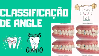 Classificação de Angle | Resumos de Odonto