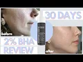 I Used Paula s Choice 2 BHA Liquid Exfoliant On My Acne Scars for 30 Days Honest Review