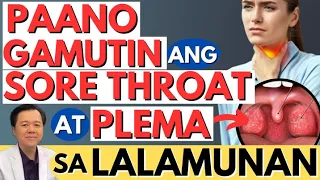 paano gamutin ang sore throat at plema sa lalamunan by doc willie ong internist and cardiologist 