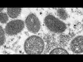 Knowing the facts about monkeypox