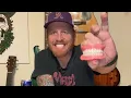 NowDenture MUST WATCH BEST Denture Unboxing How To
