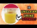 Download Lagu CLOUDY URINE: What Causes Unclear or Milky Urine