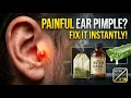 How to Get Rid of Pimples Inside the Ear