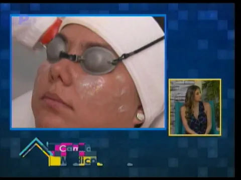 Tratamiento para las secuelas de acné