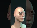 Download Lagu brain nerve aneurysm exploding meme but cringy bald guy