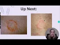 NP Learning - Picture Comparisons Made Easy Tips and Tricks for Your NP Board Review
