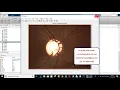 Optic disc detection with disc ratio Sensitivity Specificity and Glaucoma detection