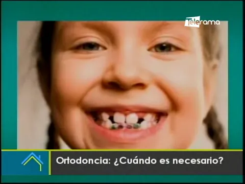 Ortodoncia ¿Cuándo es necesario?
