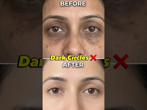 Potato Eye Mask for Dark Circles, Wrinkles & Pigmentation 🥔✨ #ashortaday