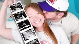 BABY MADEYEWLOOK On the Way! | 2026