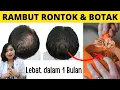 Download Lagu 3 MAKANAN PENUMBUH RAMBUT ALAMI, SOLUSI RAMBUT RONTOK DAN BOTAK