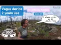 My two-year experience using a vagus nerve stimulation device