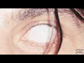 Armlock - Two Shots (Official Audio)