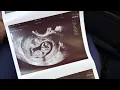 TELLING OUR FRIENDS WE PREGNANT