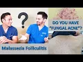 Fungal acne Malassezia folliculitis versus Comedonal acne
