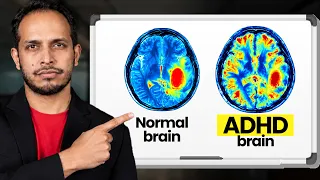 5 ADHD Problems Nobody Talks About (And How to Fix Them)