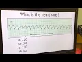 Telemetry Analysis 1 Determining Regularity and Heart Rate