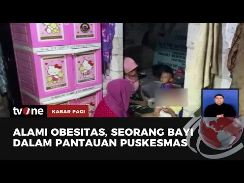 Seorang Bayi 7 Bulan di Bekasi Alami Obesitas