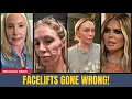 12 Real Housewives Plastic Surgery Fails Before After 2026
