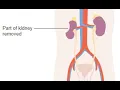 Nephrectomy CPT code - simplify medical coding