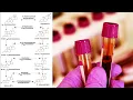 Deca And NPP Register As Testosterone On Blood Tests Test If Your Nandrolone Is Legit