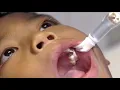 Download Lagu Pediatric Dentist Ching/Soxman.