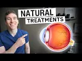 Download Lagu 5 NATURAL Ways to Prevent And Treat Macular Degeneration