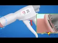 Download Lagu How is Adult Circumcision done using Stapler Circumcision Technique .