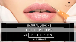 Download How To Achieve Soft, Full-Looking Lips | Dr. Chiam Chiak Teng MP3