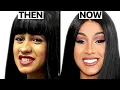 Cardi B NEW FACE Plastic Surgery Analysis