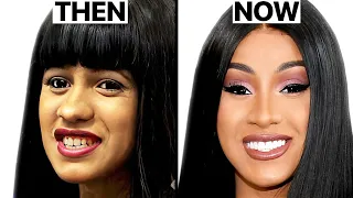 Cardi B NEW FACE Plastic Surgery Analysis