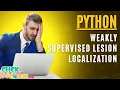 Python Image Processing - Augmentation of Visual Evidence for Weakly Supervised