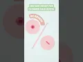 Download Lagu Postpartum Tips😲INSTANT Relief for Clogged Milk Ducts🤱#shorts