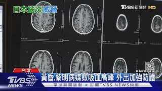 日本腦炎不只威脅幼童! 確診以「這年紀」以上成人居多｜十點不一樣20260908 @TVBSNEWS01