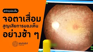 โรคจอตาเสื่อมชนิด RP คืออะไร และเกิดจากสาเหตุใด