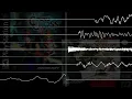 The Brink of Death — Chrono Cross (Chrono Trigger Soundfont)