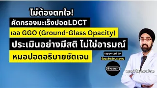 หากพบจุดฝ้าในปอดจากการสแกน CT โดยไม่มีปัจจัยเสี่ยง เช่น ไม่สูบบุหรี่ และไม่มีอาการผิดปกติ แพทย์มักแนะนำแนวทางการติดตามอย่างไร